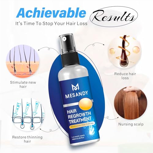 Hair growth Spray for Women and Men: Anti Hair Loss Treatment for Hair Regrowth 2 Month Supply, Extra Strength Scalp Solution, Thicken Strengthen Longer Hair 100Ml