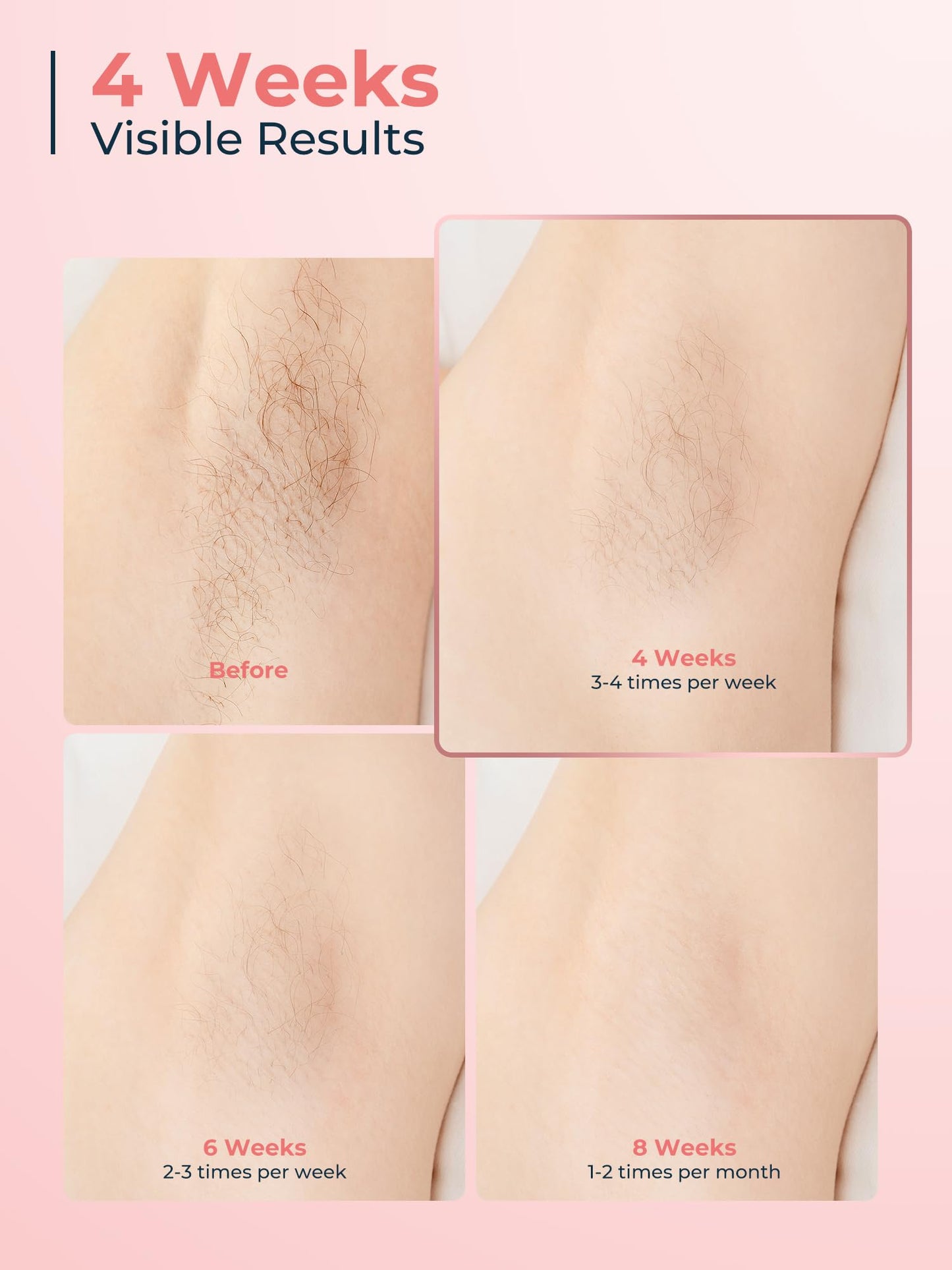 Beauris Ice-Cooling IPL Hair Removal Device, 21J Laser Hair Removal Device with 3 Functions, 9 Energy Levels, IPL Laser Hair Remover for Women Men, Facial Bikini Line Arm Armpits Leg Body, Rose Gold