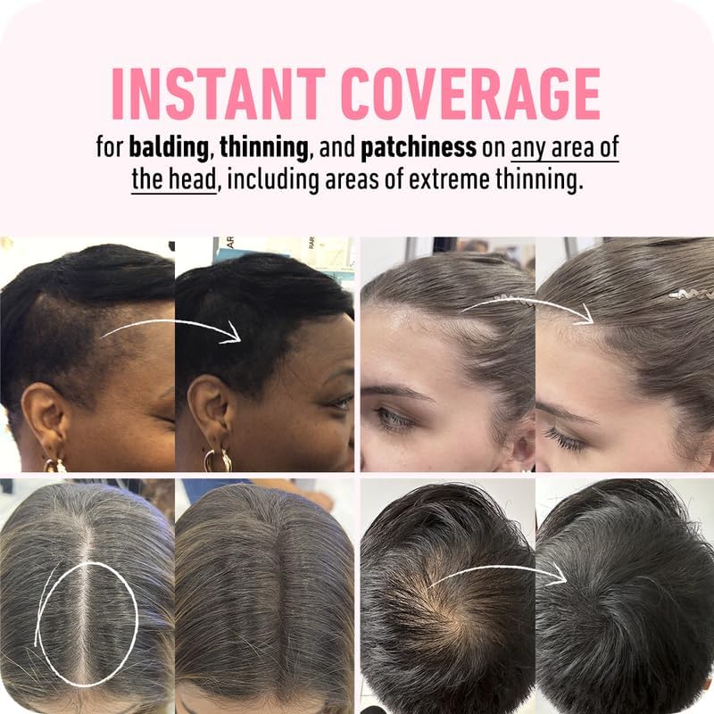 BOLDIFY Hairline Powder - Root Touch Up Hair Color for Gray Coverage - Bald Spot Concealing Hair Powder for Women and Men - 48-Hour Stain-Proof - Light Brown