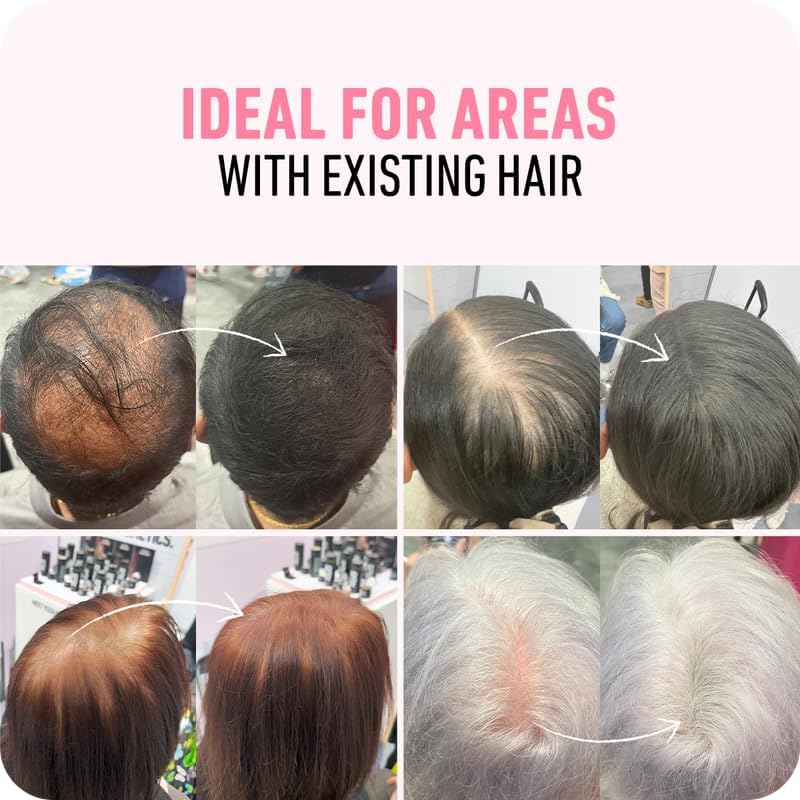 BOLDIFY Hair Fibres (28g) - Fill In Thinning and Fine Hair for an Instantly Fuller, Thicker Look - 14 Shades for Women and Men - Dark Brown