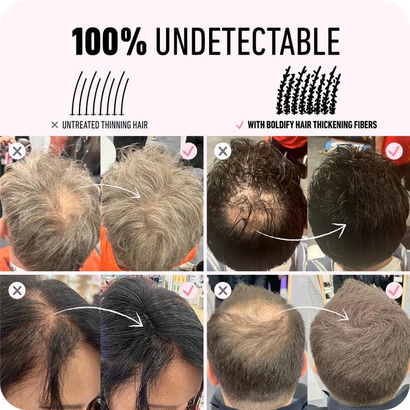 BOLDIFY Hair Fibres (28g) - Fill In Thinning and Fine Hair for an Instantly Fuller, Thicker Look - 14 Shades for Women and Men - Dark Brown