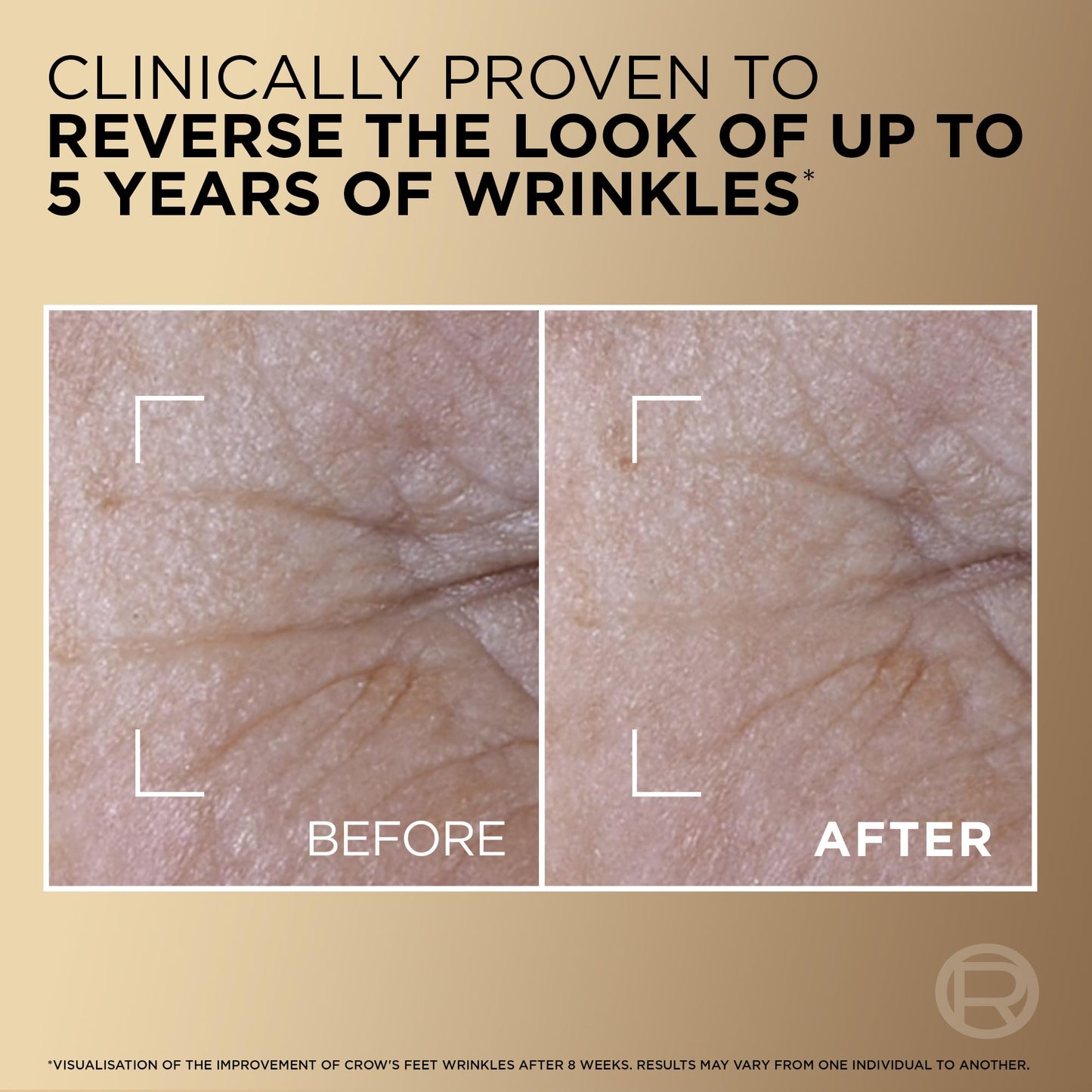 L’Oréal Paris Age Defying Serum Le Duo, Collagen Peptide Booster and Vitamins B3 & C*, Instant Firmness & Radiance, Clinically proven to reverse the look of up to 5 years of wrinkles*, 30ml
