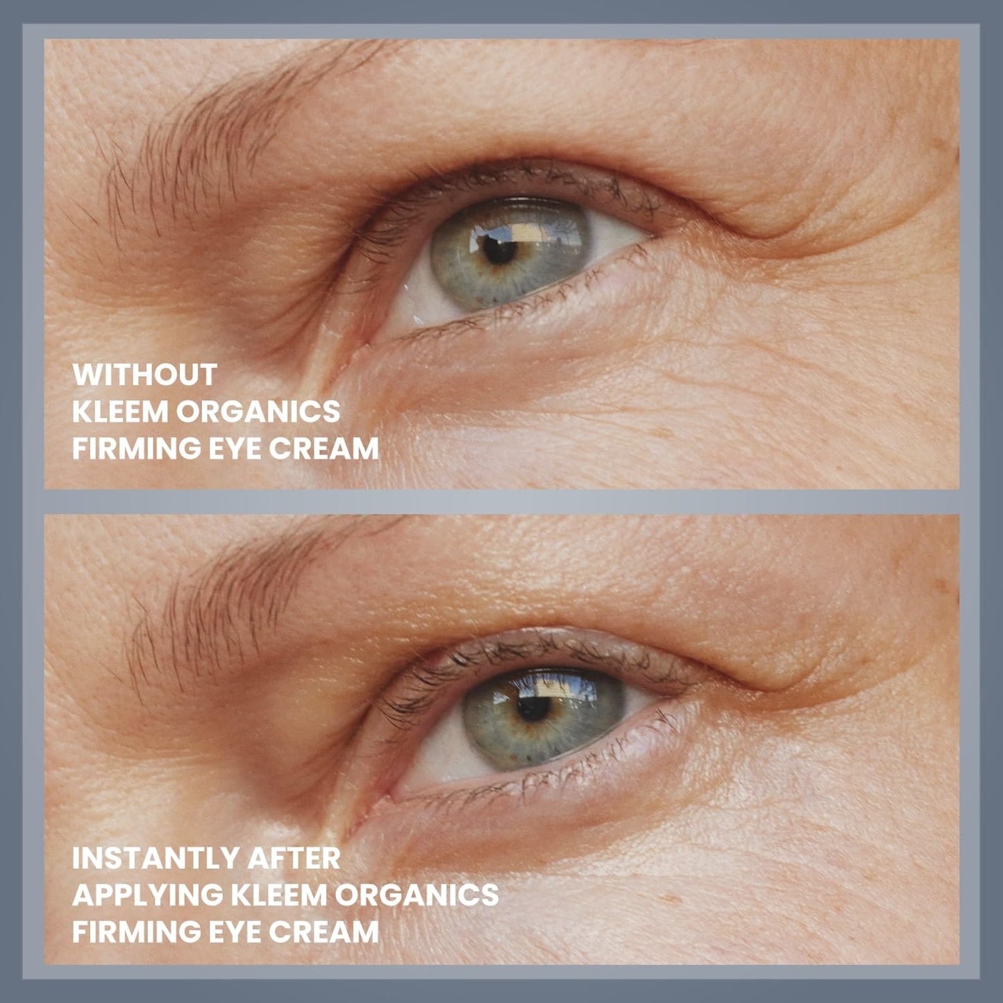 Anti Wrinkle Eye Gel for Dark Circles & Puffy eyes with Peptides and Niacinamide that Reduces Eye Bags, Crow's Feet, Fine Lines & Sagginess - Natural & Organic Under Eye Gel for Wrinkles - 15ml