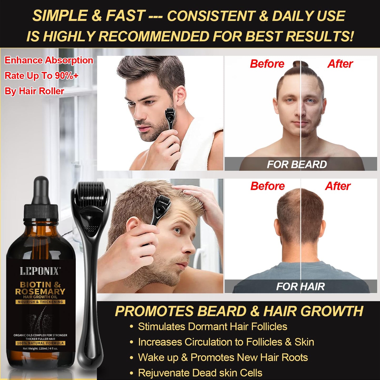 Rosemary Oil for Hair Growth, 120ml Diluted Rosemary Oil Hair Growth Serum with Derma Roller & Scalp Massager Hair Thickening Products Hair Loss Treatment for Men Women, Stocking Fillers