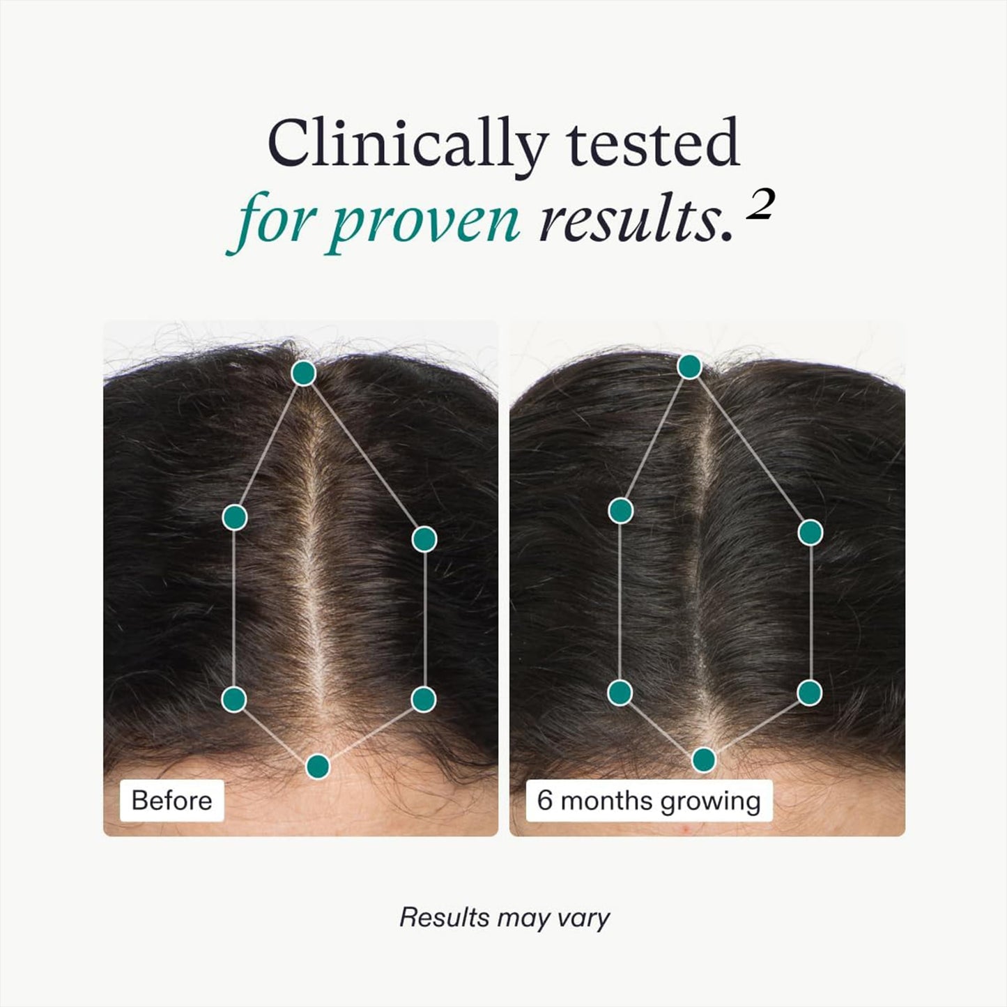 Nutrafol Women NEW Introducing Nutraceutical Hair Loss Supplement Patent Pending Synergen Complex Clinically Tested Ingredients Next Generation Formulation