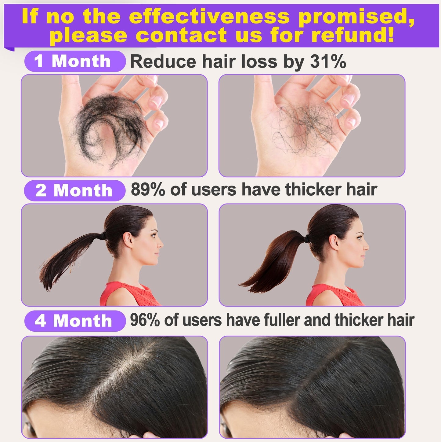 Rosemary Oil for Hair Growth,Hair Growth Serum With Castor Oil Biotin Argan Oil Hot Oil for Dry Damaged Hair,Hair Ingrown Regrowth Loss Treatments for Women Men w/Sclap Massager Ebook