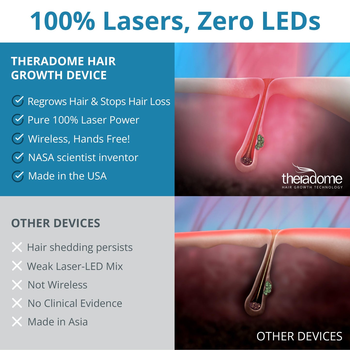 Theradome PRO LH80 Laser Helmet for Hair Loss Treatments in Men and Women. (LH80 PRO), White
