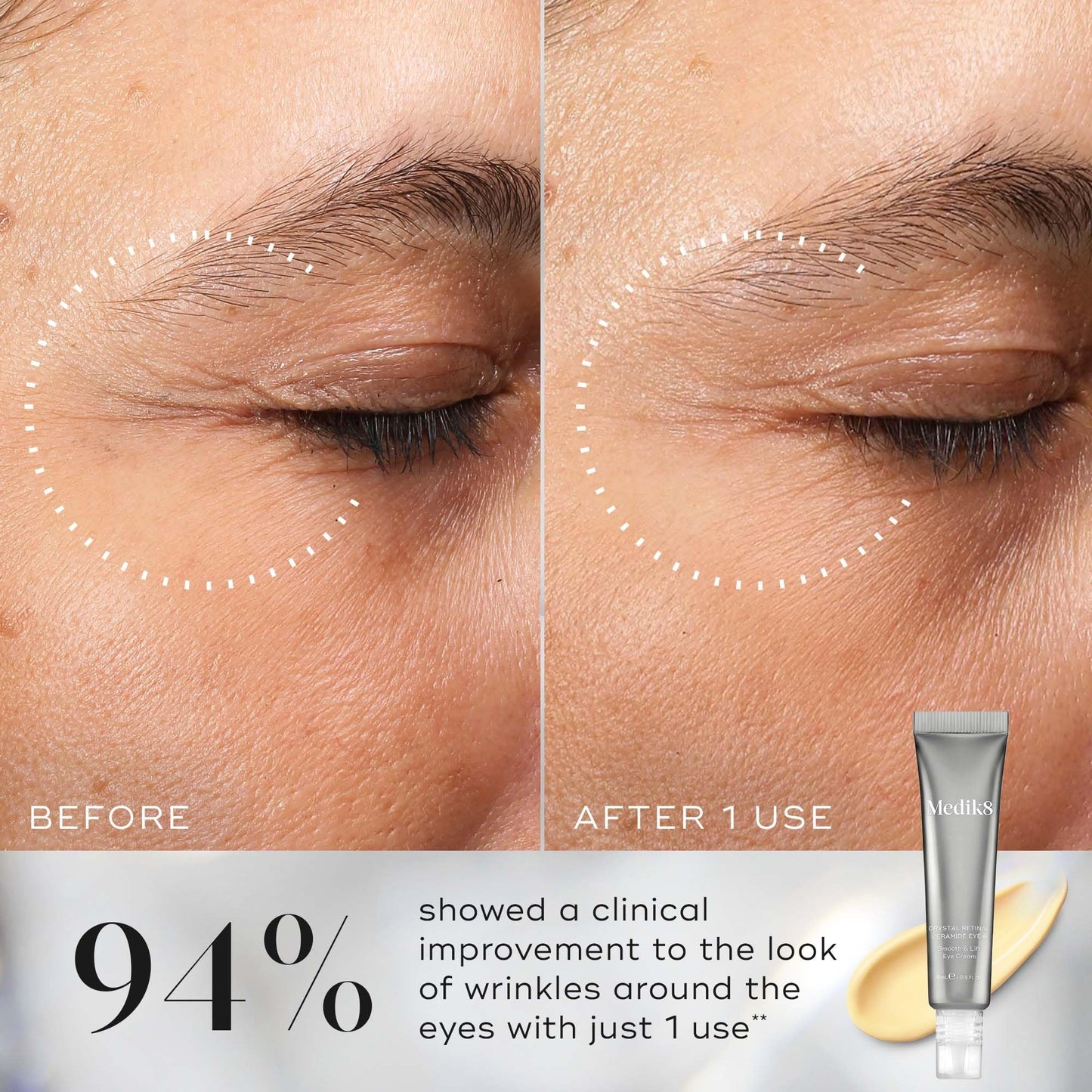 Medik8 Crystal Retinal Ceramide Eye Cream 0.03% | TRYTLION