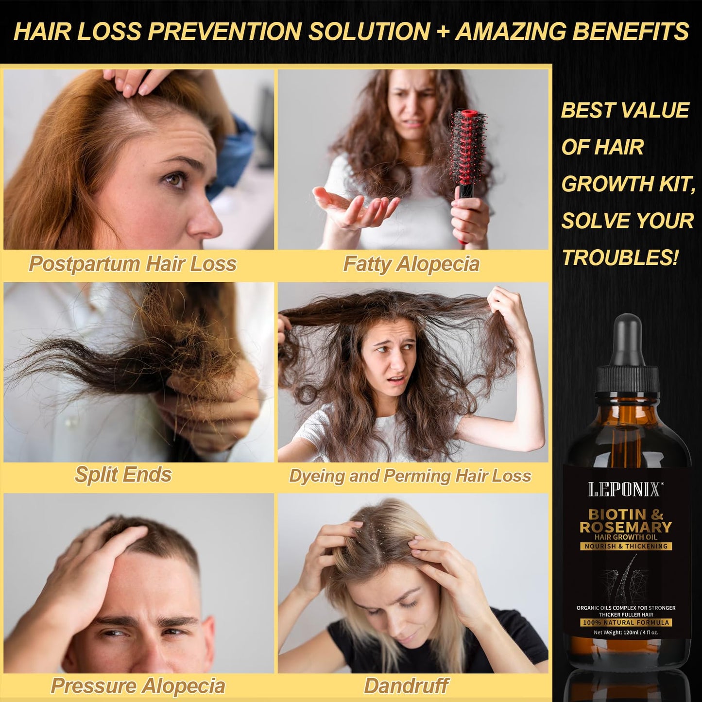 Rosemary Oil for Hair Growth, 120ml Diluted Rosemary Oil Hair Growth Serum with Derma Roller & Scalp Massager Hair Thickening Products Hair Loss Treatment for Men Women, Stocking Fillers