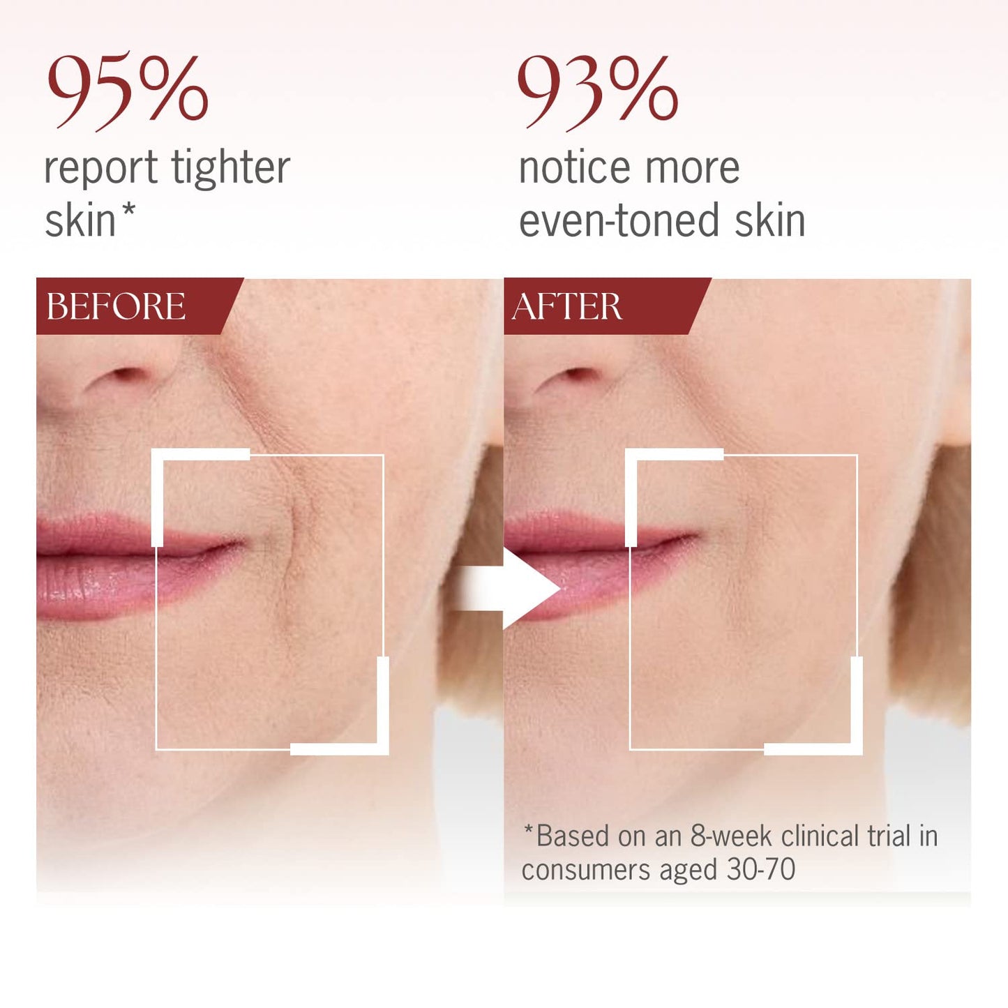 NeverWithout Retinol Serum with Hyaluronic Acid – Consists of Firming Copper Peptides & Collagen, Retinol Night Cream with Vitamin E & B5 for Cell Regeneration – Anti-Aging Serum for Face 30ml