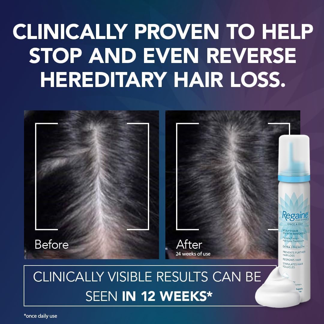 Regaine for Women 5% Minoxidil Extra Strength Scalp Foam for Hair Regrowth (2x 73ml), Scientifically Proven to Help Stop and Reverse Hereditary Female Hair Loss, Revitalise Hair Follicles