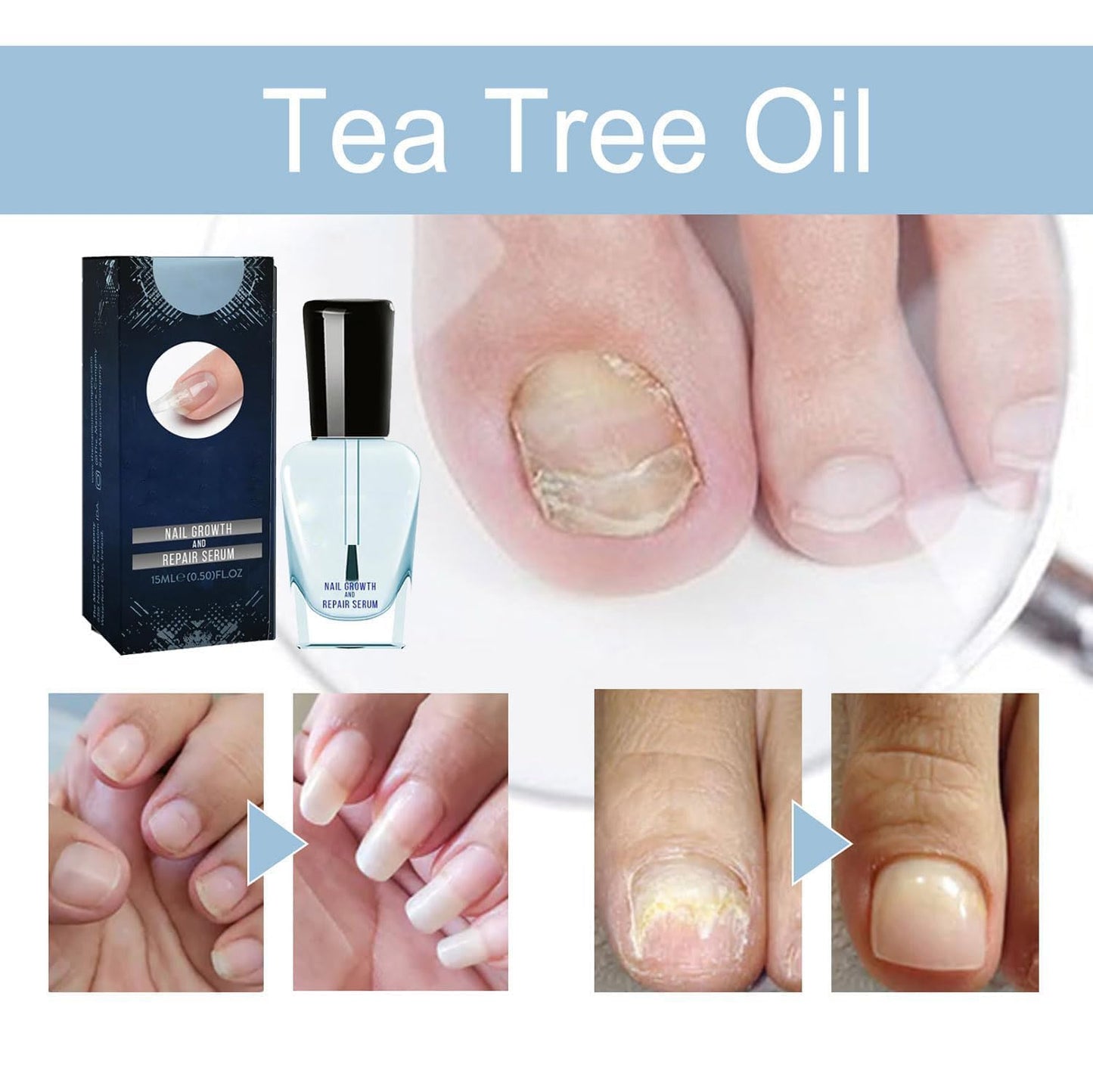 2PCS Onyxoguard Nail Repair & Growth Serum, Nail Strengthening Conditioner