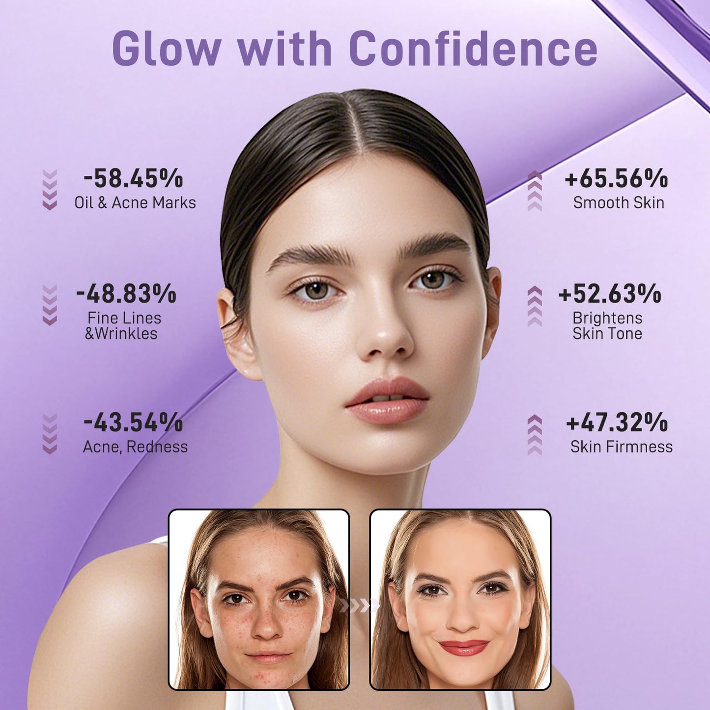 Lovsheme LED Face Mask - Professional Grade Skincare at Home – FDA Approved Red Light Therapy Mask for Acne, Wrinkles, and Skin Rejuvenation – 3 Light Modes – Remote Control – Includes Eye Protection