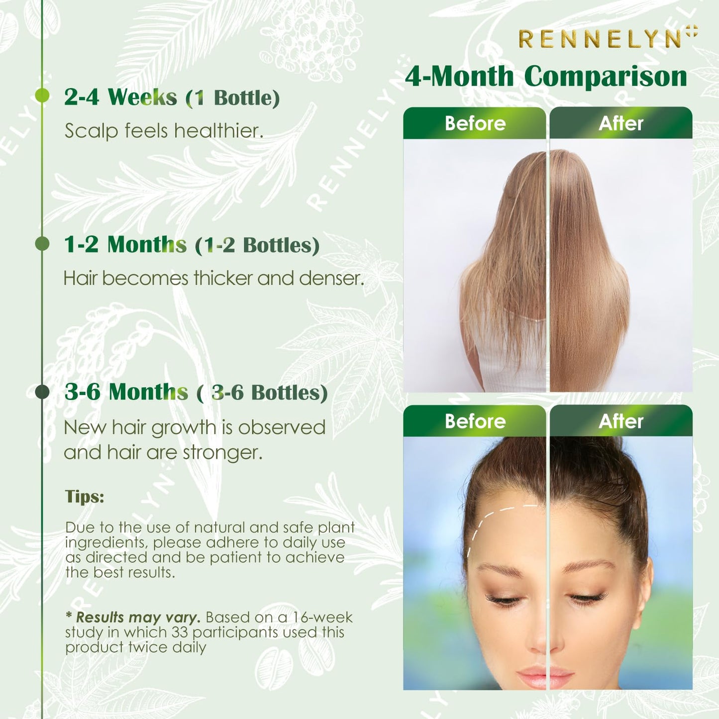 Natural Hair Growth Oil Spray: Rosemary Castor Batana Oil with Rice Water Lotion for Hair Growth and Thickening, 60 mL – Hair Loss Treatment For Women