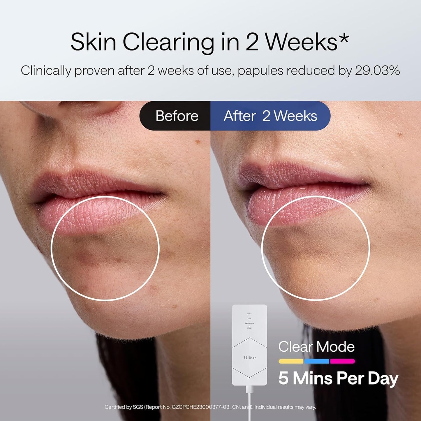 ReGlow LED Face Mask – 4-in-1 Light Therapy Mask