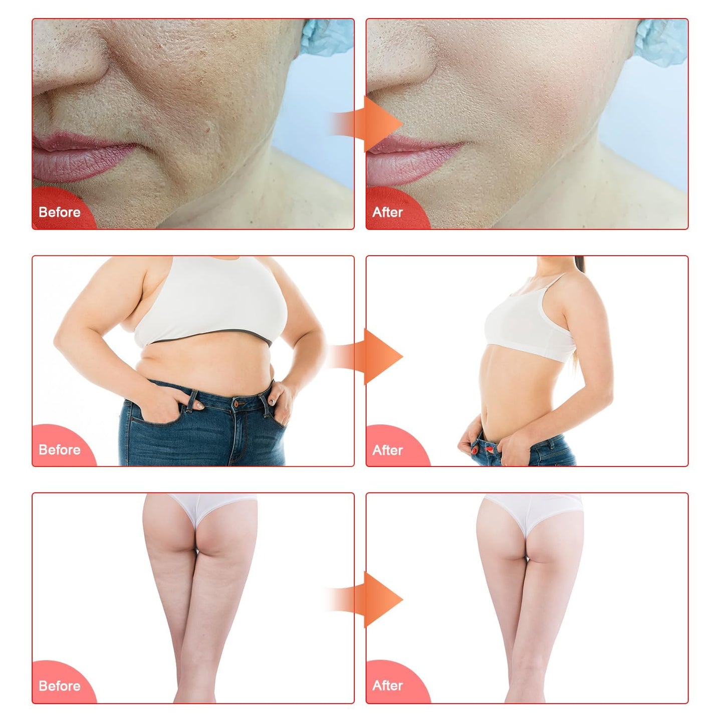 Elitzia 4 in 1 Body Shaper Beauty Machine Skin Care Tool Rf Cavitation Vacuum Multipole Device Salon Spa Equipment Home Use Massager for Arm Waist Belly ETLW202