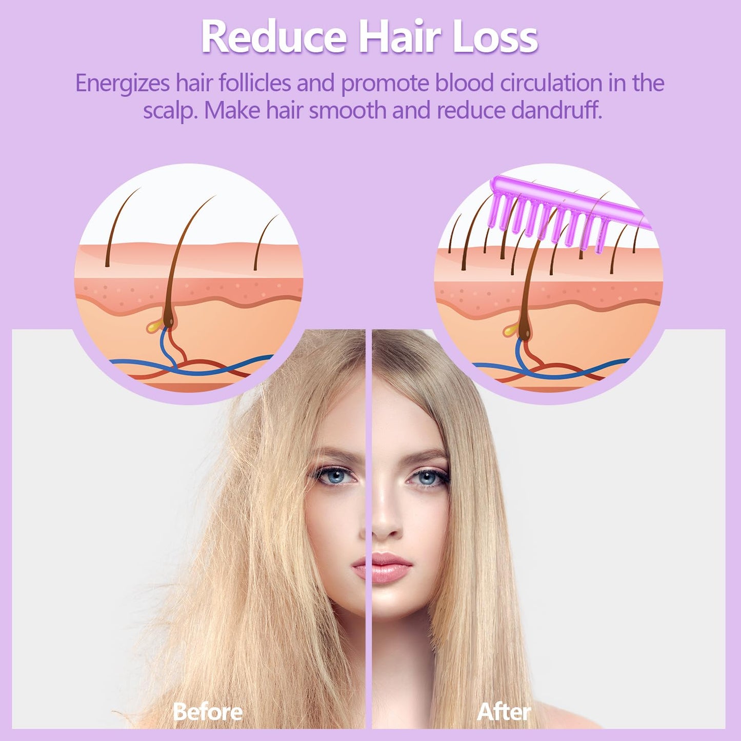 High F-requency Wand, iklestar Handheld High F-requency Facial Machine for Hair Growth, Skin Tightening Kit with 4 Violet Tubes, Professional Face Beauty Device for Skin Care Home Salon Use
