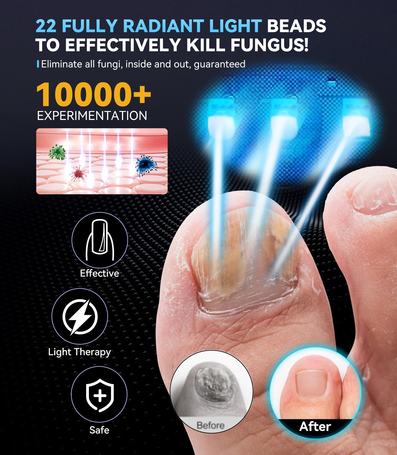 Nail Fungus Laser Device Antifungal Laser【SGS-Certified】 for Toenail Fungus Treatment【Clinically Proven 21Day Fast Repair】PainFree Device Professional Laser Nail Fungus Treatment for Toenail