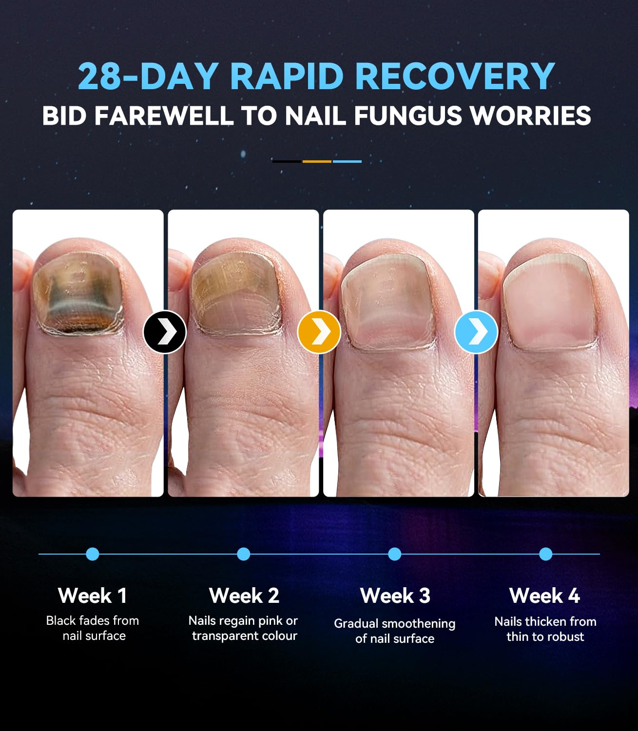 Nail Fungus Laser Device Antifungal Laser【SGS-Certified】 for Toenail Fungus Treatment【Clinically Proven 21Day Fast Repair】PainFree Device Professional Laser Nail Fungus Treatment for Toenail