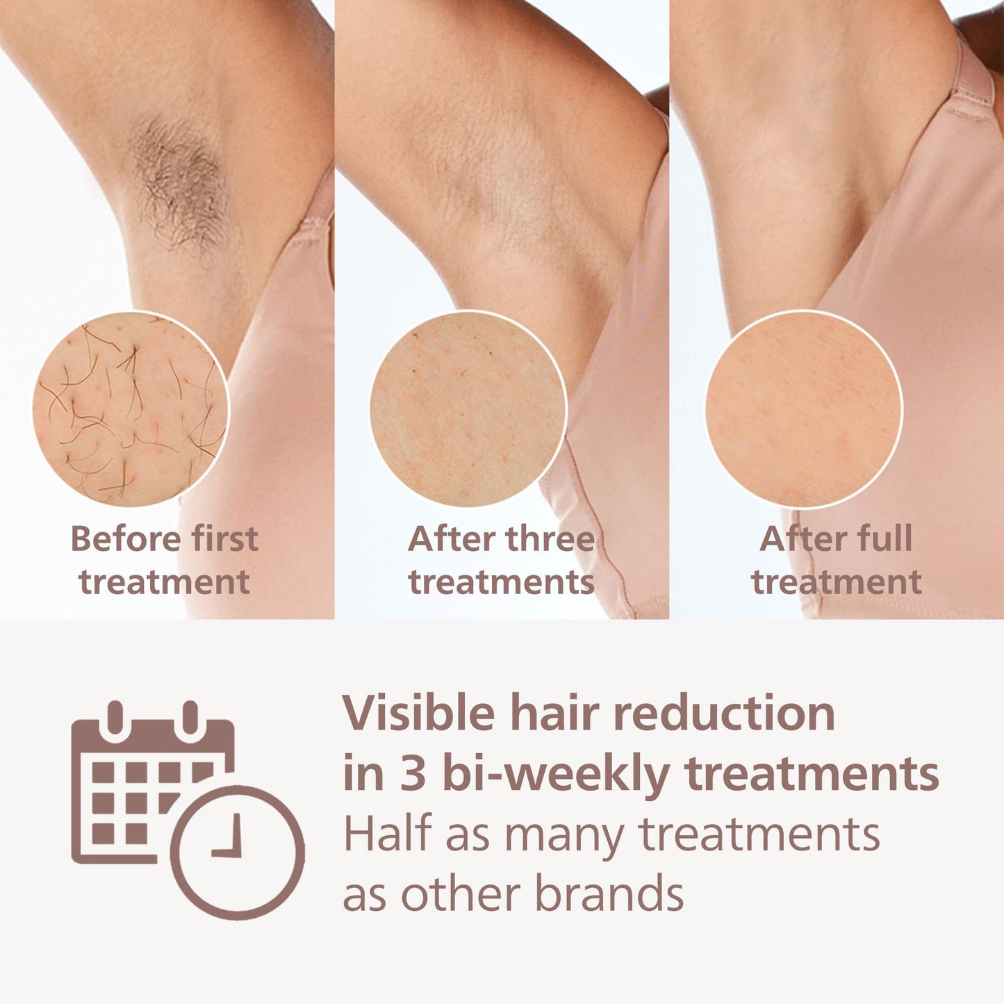 Philips Lumea Series 8000, IPL Hair Removal Device, with SenseIQ Technology, 4 Attachments for Body, Face, Bikini and Underarms, Satin Compact Pen Trimmer, Model BRI949/00