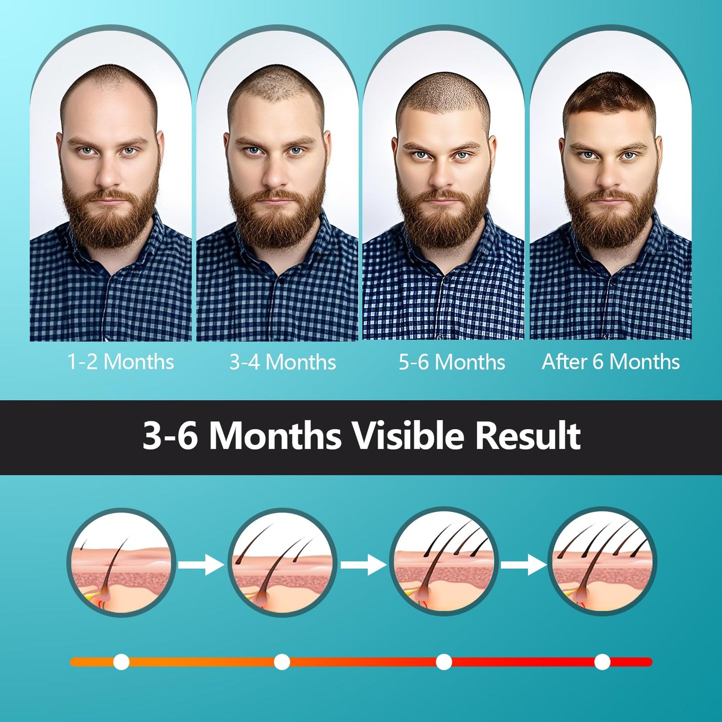iKeener Laser Hair Growth Cap, FDA Cleared Wireless 660nm & 850nm Red Light Cap for Hair Regrowth, for Hair Loss & Hair Thinning in Men and Women