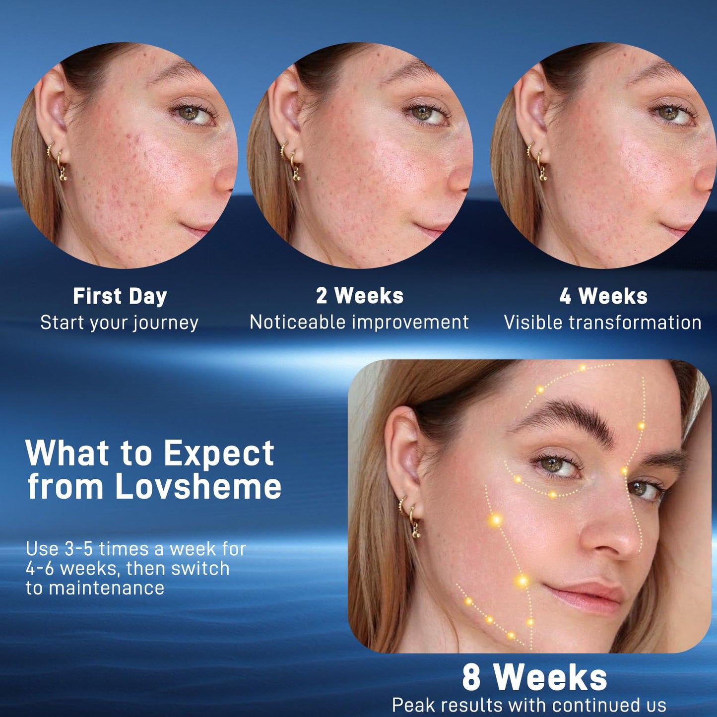 Lovsheme LED Face Mask – Wireless Red Light Therapy