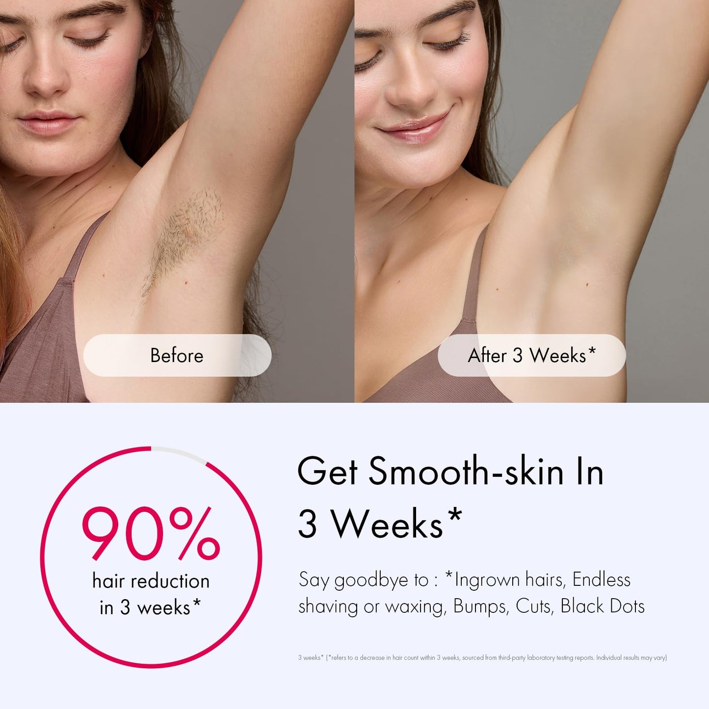 IPL Hair Removal, Ulike Air 3 Patented Sapphire Ice Cooling Technology for Truely Painless Hair Remove Experience, from Face to Toes IPL Hair Removal Device for Women and Men, Dark Purple