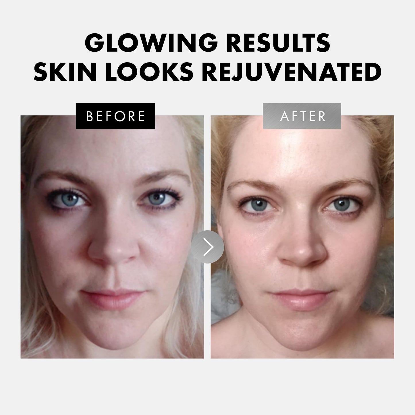 Eclat Skincare Face Serum Set – Vitamin C, Retinol & Hyaluronic Acid (3-Pack)