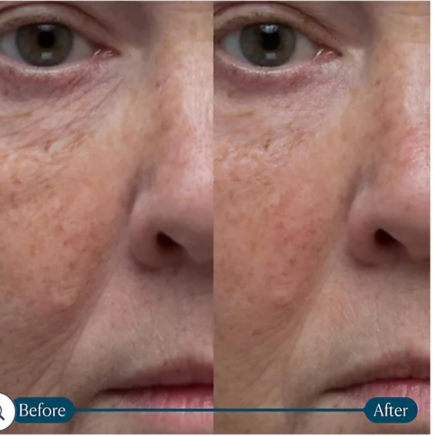 ELE-MIS Pro-Collagen Gift Set (6-Piece)