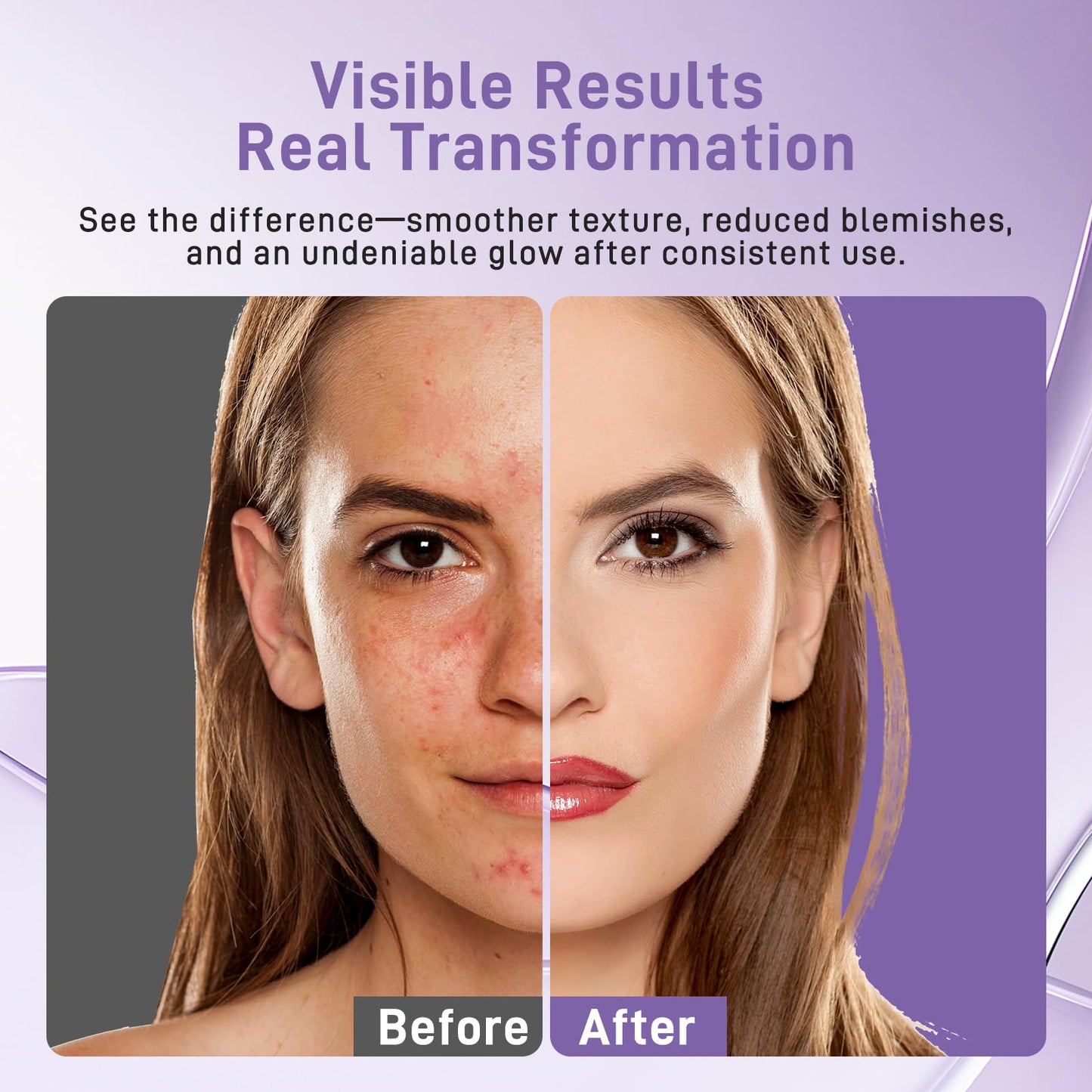 Lovsheme LED Face Mask - Professional Grade Skincare at Home – FDA Approved Red Light Therapy Mask for Acne, Wrinkles, and Skin Rejuvenation – 3 Light Modes – Remote Control – Includes Eye Protection