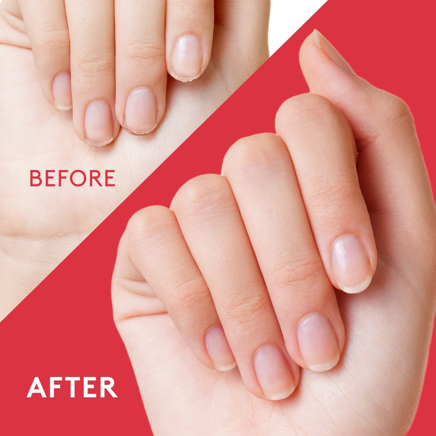 Mylee The Bite Stuff - Stop Biting Your Nails - prevention/Anti nail biting polish For adults & children - Clear nail varnish, Fast and Easy application - Water Resistant