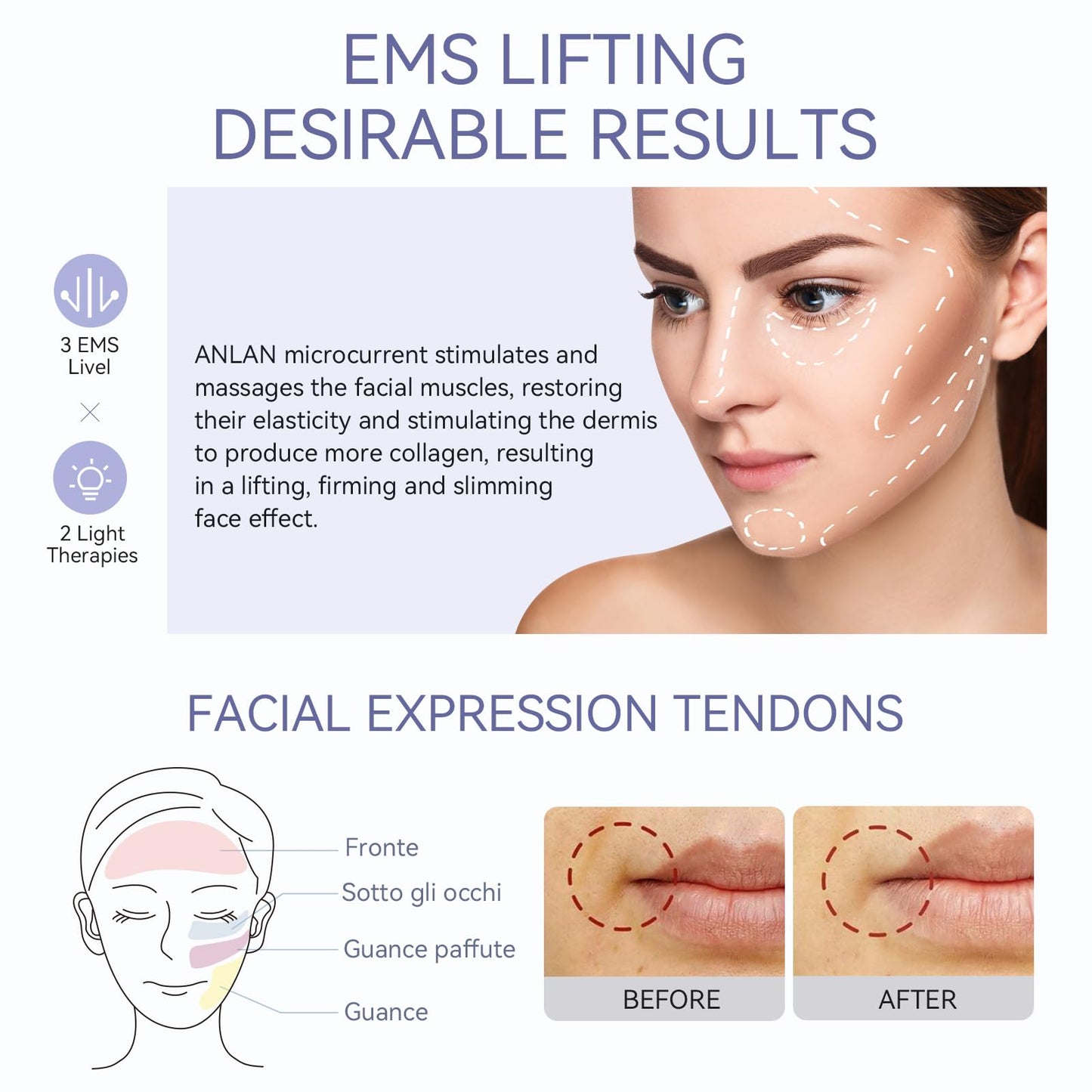 ANLAN Face Massager for Skin Care,Beauty Device Multi Anti-Wrinkle High-Frequency EMS Facial Lifting Toning with Red/Blue Machine,Skin Rejuvenation and Tightening
