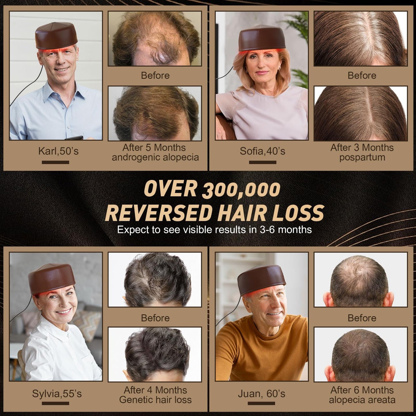 iKeener Laser Cap for Hair Growth, FDA Cleared 660nm & 850nm Red Light Therapy Cap for Hair Regrowth with 120PCS Lamp, Natural Hair Loss Therapy for Men and Women (Brown)