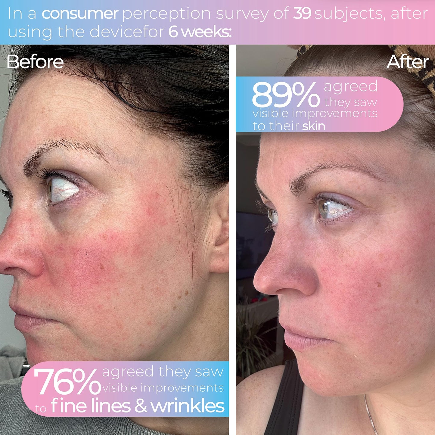 STYLPRO Wavelength LED Face Mask – Multi-Mode Light Therapy